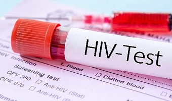 1,300 applicants tested HIV positive in security agency recruitment – Minister